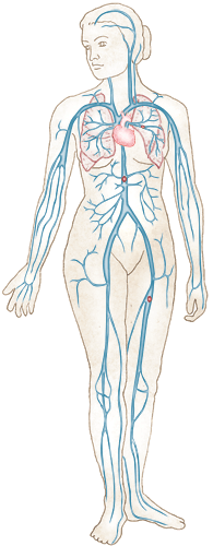 Deep-vein thrombisis illustration